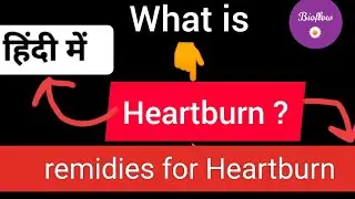 Heartburn kya hai? सीने में जलन होना। Remidies for Heartburn | heartburn hone par kya krein?