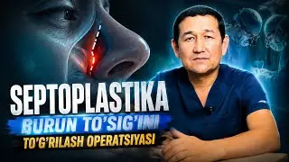 Septoplastika | Burun to‘sig‘ini to‘g‘rilash operatsiyasi | Barcha savollarga javob! | Bobur Zulunov