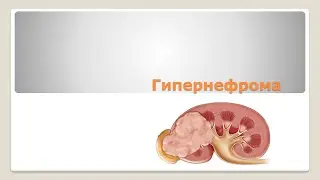 Гипернефрома