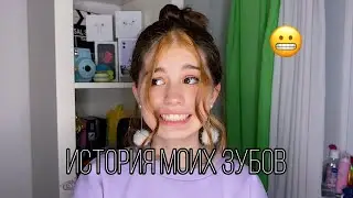 история моих зубов и мучений