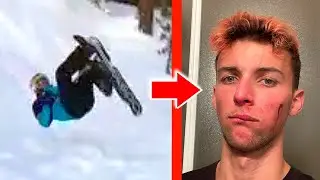 MON ACCIDENT LE PLUS GRAVE (en trottinette des neiges)