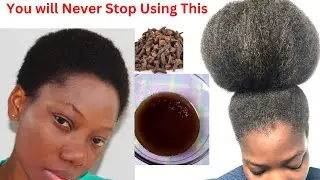 I Got to Use This Twice weekly and My Hair Grew Like Crazy Regrow Bald Spots & Thicken Hair fast