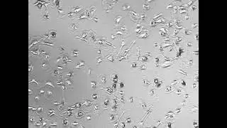 Macrophages with cytokine nanoparticles looking for trouble