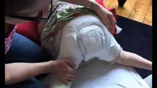Hip Spica-Older-Child-Cast-Care.mp4