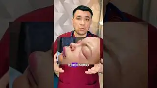 Как помочь при крапивнице и отеке квинке?