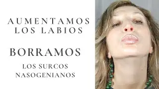 👍|Borramos los surcos nasogenianos y aumentamos los labios 👌