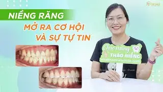 Niềng răng mở ra nụ cười mới, gia tăng sự tự tin - KH Nguyễn Thanh Huyền