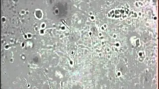 ПКТ отрицательный 4