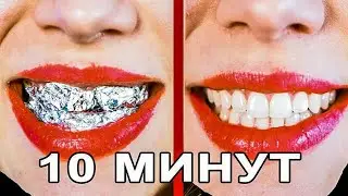 тиш окартириш,тез ва осон, фойдали маслахатлар, отбеливание зубов