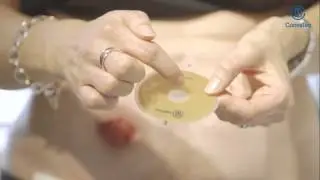 Esteem™ + One-Piece Moldable Application video