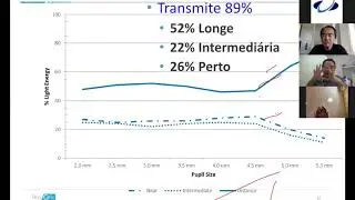 1° Webinar Adapt  - Dr. Milton Yogi e Dr. Gilberto Shimoda - Minha Experiência em Lios Trifocal