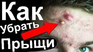 😍Реально работает, прыщей не осталось. Сильная маска от прыщей