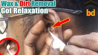 ►Cleaning the Ears will be Very Comfortable-008