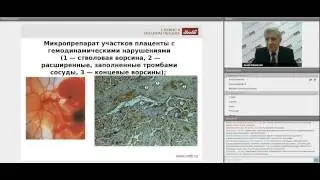 Лабораторные алгоритмы ведения беременности. Пренатальный скрининг сегодня. Никулин Б.А.