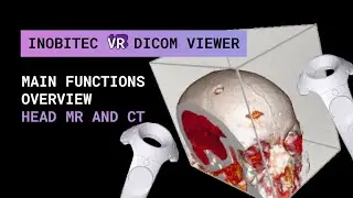 Inobitec VR DICOM Viewer functionality overview. Head MR and CT.