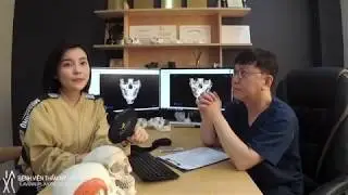 Hé lộ kết quả phẫu thuật sau 7 tháng gọt hàm và hạ gò má tại Hàn Quốc của diễn viên Cao Thái Hà