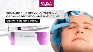 Ревіталізація верхньої третини обличчя Prostrolane Natural-B: техніка мікроін'єкцій