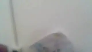 Укус 87