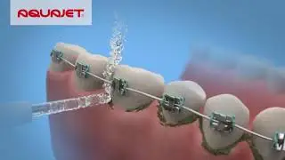 Как правильно пользоваться ирригатором