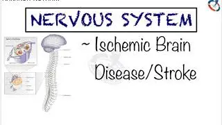 Ischemic Brain Disease/Stroke | Nervous System Pathology by Aakansh Kothari
