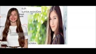 Umuda Kelepçe Vurulmaz Önceki Ve Sonraki Halleri