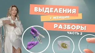 ВЫДЕЛЕНИЯ У ЖЕНЩИН. Разборы, часть 2.