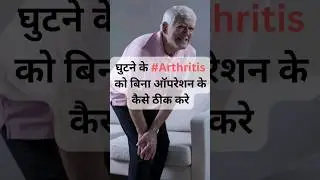 घुटने के #Arthritis को बिना ऑपरेशन के कैसे ठीक करे,PRP थेरेपी करवाओ. Avoid knee replacement.