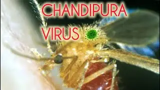 Chandipura virus 🦠 