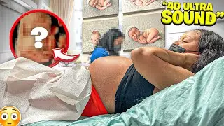 YOU WON'T BELIEVE WHO OUR DAUGHTER LOOKS LIKE 👶🏻 *4D ULTRASOUND*