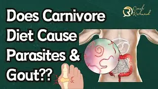 Debunking Carnivore Diet Myths: Parasites and Gout