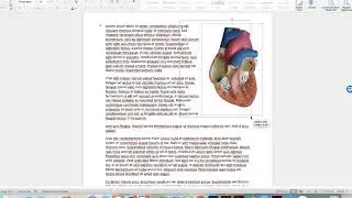 How to wrap text around an irregular picture using a text box in Word