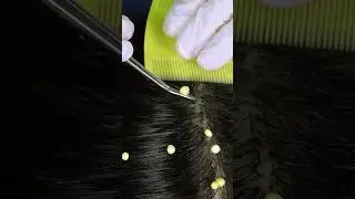 #ASMR
