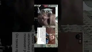 ДУНЁДАГИ ЭНГ ЖИРКАНЧ МАХЛУКЛАР.🤮