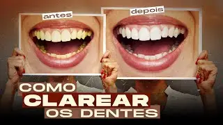 como CLAREAR OS DENTES no photoshop