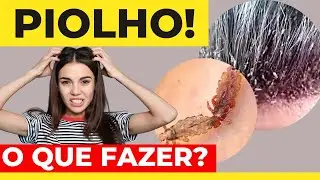 Como acabar com piolhos [Quem são eles?]