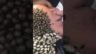 Самые опасные насекомые