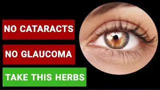 No Cataracts No Glaucoma take this Herbs!