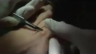 Cómo eliminar los callos de los pies
