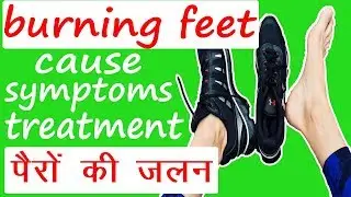 Burning Feet Cause Symptoms Treatment | How to Treat Burning Feet