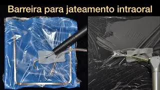 Sugestões de barreira para jateamento intraoral com óxido de alumínio.