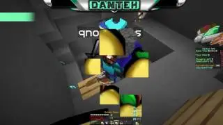 UHC Highlights #70 - what the