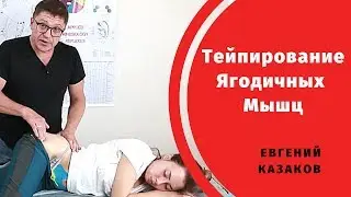 КИНЕЗИТЕЙПИРОВАНИЕ. ТЕЙПИРОВАНИЕ ЯГОДИЧНЫХ МЫШЦ. 