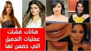فنانات فشلت عمليات التجميل التي خضعن لها فكانت النتيجة عكسية تماماً !