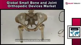 Global Small Bone and Joint Orthopedic Devices Market