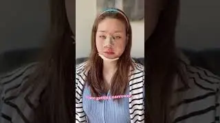 [SHORTS] Stunning transformation from ptosis correction and Rhinoplasty at NANA