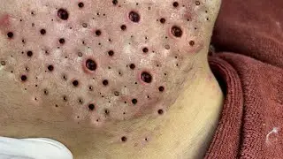 تلميع وتنظيف الجلد الطبيعي المدور 1413608