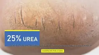 Cómo eliminar los talones agrietados
