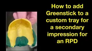 How to adapt a custom tray and create a function border with Greenstick.