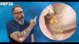 This Is Why You Shouldn't Ignore Your Ears - MEP26