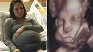 Parents dreamed of a daughter but got something they were completely unprepared for